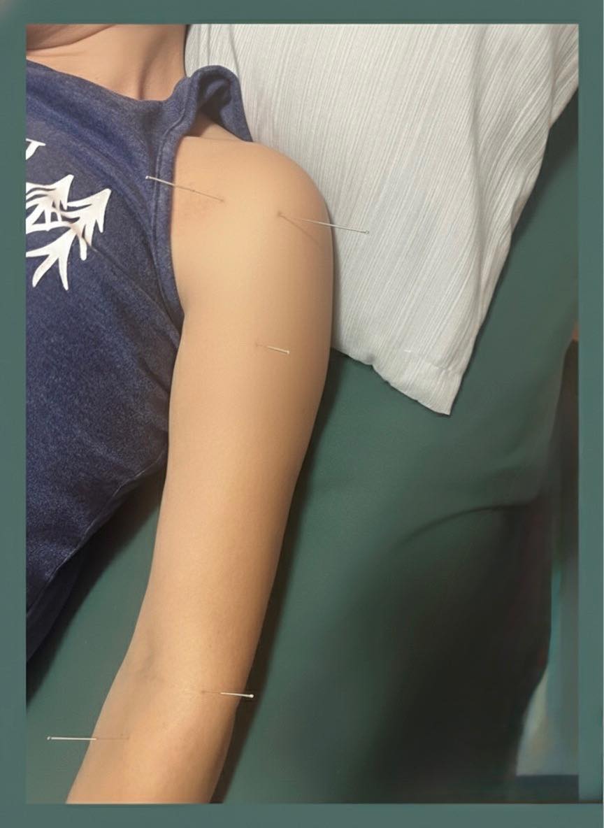 Services - Pain Relief Image