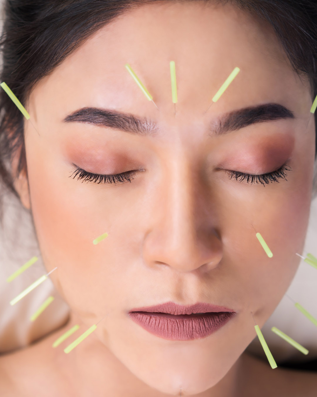 Services - Facial Acupuncture Image